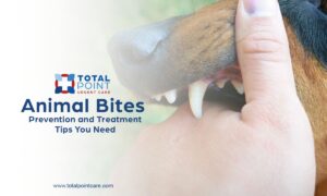 What to Do if Bitten by an Animal: Prevention, Treatment, and Rabies Risks