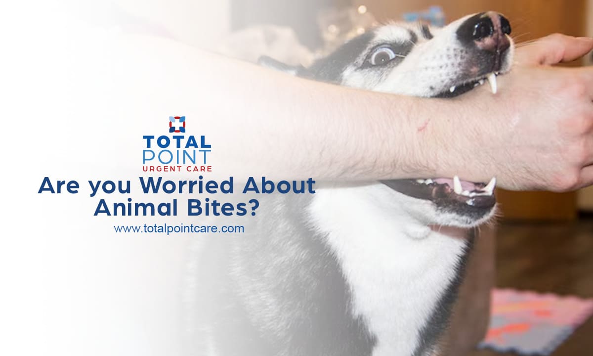 Are you Worried About Animal Bites?